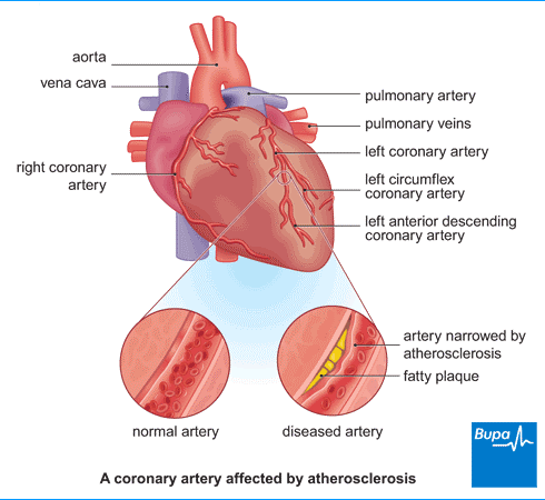 Acana and heart best sale disease